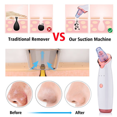 Pore Cleaner Vacuum